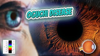 Oguchi disease - Your EYEBALLS - EYNTK 👁️👁️💉😳💊🔊💯✅