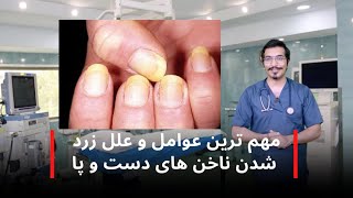 علت زرد شدن ناخن ها چیه ؟