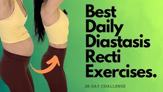 Heal & Flatten With These Daily Diastasis Recti Exercises!