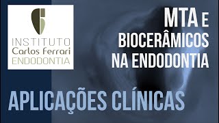 MTA e Biocerâmicos na Endodontia - 2a parte. Aplicações clínicas.