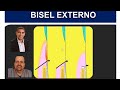 BISEL EXTERNO  @dr.alexguedes