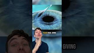How Lasik Eye Surgery Works