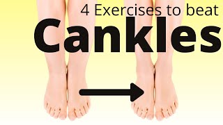 4 exercises to define your calves - lose cankles fast!