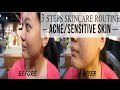 ATORREGE AD+ Steps 1,2,3 Skincare Routine Part II by Skin & Co