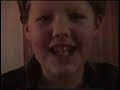 Drew gets braces 1996