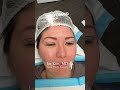 Your most beautiful eyes with Jae Kim, MD facial plastic surgeon Northern Virginia