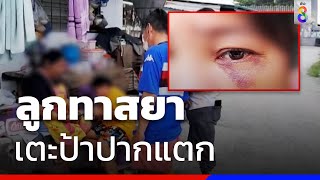 ลูกทาสยา-เตะป้าปากแตก | ข่าวช่อง8