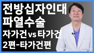 전방십자인대 파열 수술, 자가건과 타가건의 선택 - 2편 타가건의 장단점