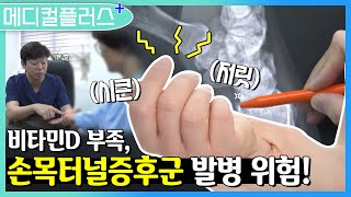 【메디컬플러스】 손목🤛🏻 에 저림, 시큰시큰⚡️ 현상이 나타난다면? 손목터널증후군의 원인과 특징!