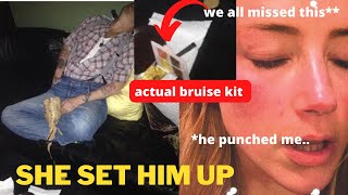 NEW PROOF AMBER HEARD BRUISE KIT IN PICTURES OF JOHNNY DEPP.. SMART BUT NOT SMART ENOUGH!!