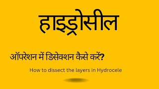 Hydrocele Operation - Dissection of anterior layers| Hydrocele surgery| Dissection of Scrotal skin