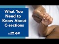 What you need to know about C-sections