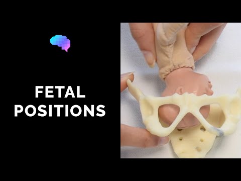 Can baby move from cephalic position?