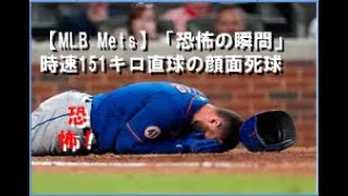 【MLB】Metsピラーが「恐怖の瞬間」151キロ直球の顔面死球に球場＆米メディア騒然