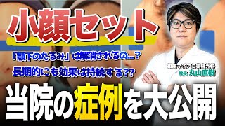 大人気メニュー「小顔セット」の症例を大公開！【銀座マイアミ美容外科】