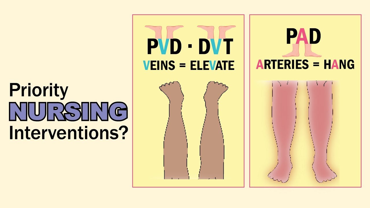 Peripheral Artery Disease PAD Vs Peripheral Vascular, 49% OFF