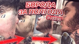 Борода за пол года. Пацанский бьюти-блог. Миноксидил? Советы. Лайфхаки!