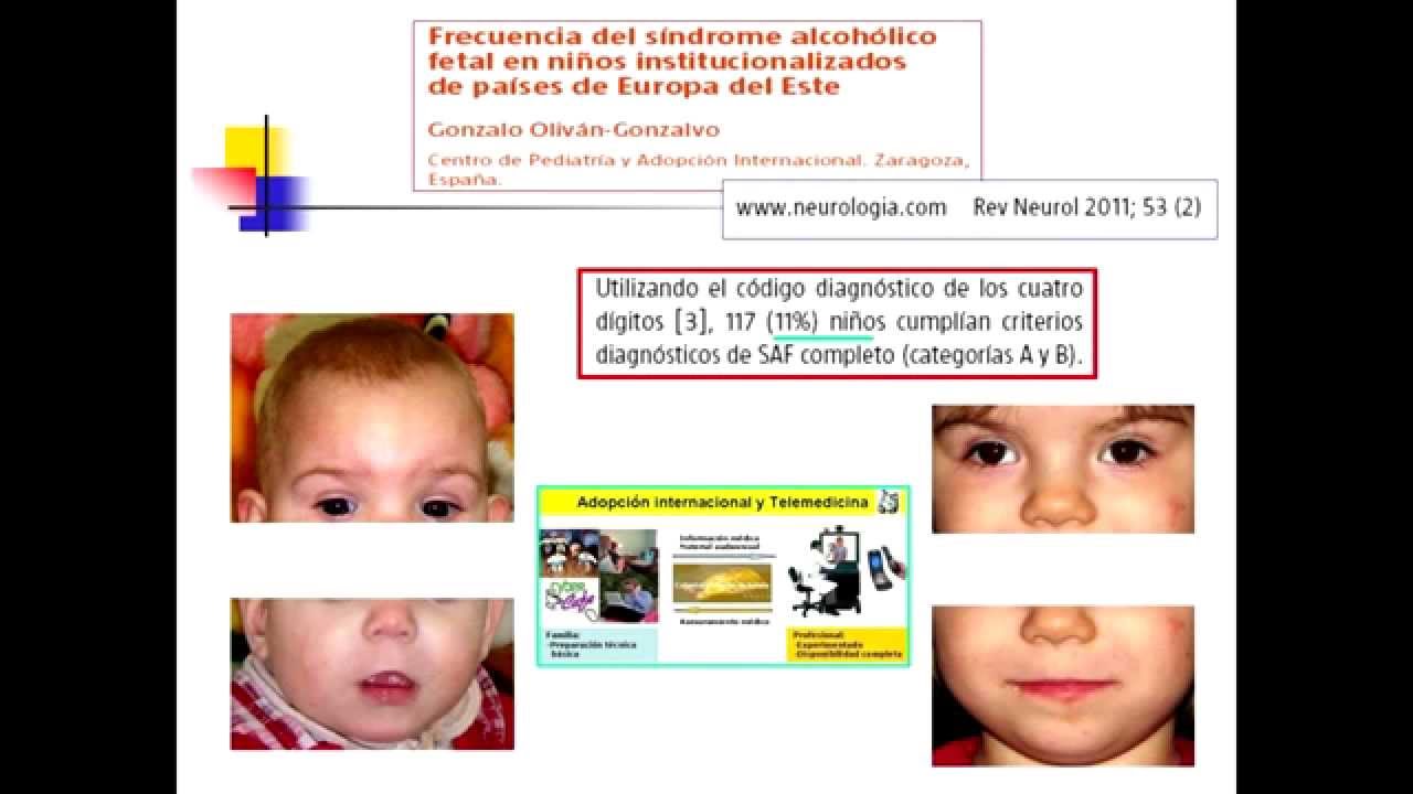 Trastornos Del Espectro Alcohólico Fetal (FASD) En Adopción ...