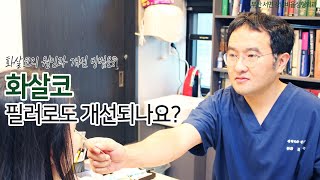 [부산 성형외과]화살코 필러로도 개선되나요?