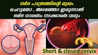 ഗര്‍ഭധാരണം വേഗത്തിലാകാന്‍ സര്‍വിക്സ് ആരോഗ്യം | closed cervix vs open cervix