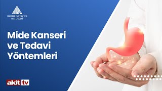 Mide Kanseri ve Tedavi Yöntemleri