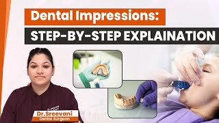 How Are Dental Impressions Taken | Dental Impressions Complete Process Explained | Eledent Dental