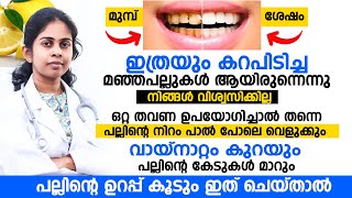 ഇത് ഒറ്റതവണ ഉപയോഗിച്ചാൽ തന്നെ പല്ലിന്റെ നിറം പാല് പോലെ വെളുക്കും |വായ്നാറ്റം കുറയും പല്ലിന്റെ കേടുകൾ