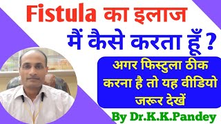 Fistula ka best treatment kya hai | Fistula in ano | Fistula ka Treatment मैं कैसे करता हूँ
