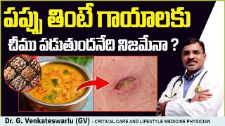 పప్పు తినడం మంచిదా❓| Health Benefits Of Pappu | Myths Busted About lentils \u0026 Wounds | Sriraksha