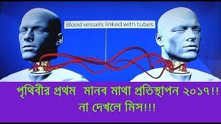 Breaking News !! পৃথিবীর প্রথম মানব মাথা প্রতিস্থাপন ...