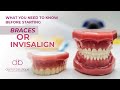 What You Need To Know Before Starting Invisalign OR Braces | An In Depth Look Dental Boutique