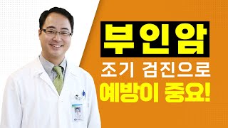 [서울성모병원] '부인암' 조기 검진으로 예방이 중요! - 산부인과 이근호 교수