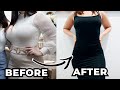 Liposuction: Before and After Post Pregnancy Testimonial