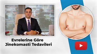 Gynecomastia Treatments According to Stages⁣ | Assoc. Dr. Erdem Guven