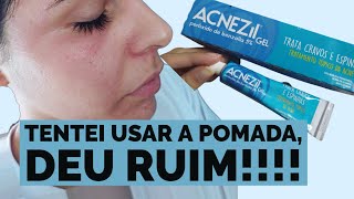 RESENHA ACNEZIL GEL - POMADA CONTRA CRAVOS E ESPINHAS | TESTEI, COMO FOI??