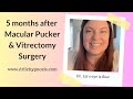 5 months post eye surgery macular pucker and vitrectomy with Dr  Liz