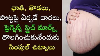 ఛాతీ, తొడలు, పొట్టపై ఏర్పడే చారలు, ప్రెగ్నెన్సీ స్ట్రెచ్ మార్క్స్ తొలగించుకునేందుకు చిట్కాలు