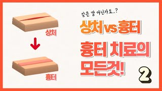 상처 vs 흉터! 흉터치료의 모든것! [닥터유티비 7화 흉터의 모든것! 2편]