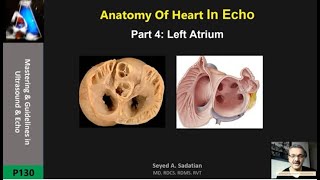 Anatomy Of Heart In Echo Part 4: Left Atrium