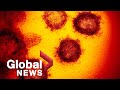 Coronavirus: 