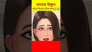 মাথার উকুন যেভাবে ছাড়ে 🤔😱 #shorts #youtubeshorts #viral #asmr #shortsfeed #bangla #science #ytshort