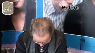 Toppik demonstration. Fibers thicken your hair. See the difference!