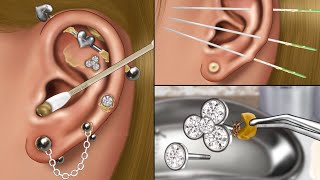 ASMR Piercing Cleaning Animation👂, Blackhead, Removing Pus from Piercing, Ear Infection Treatment