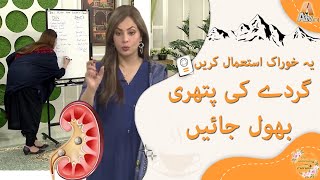 KIDNEY STONE DIET PLAN and Prevention | گردے کی پتھری اور خوراک کا استعمال