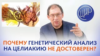 Анализ на целиакию без сдачи генетики - достоверен или нет? Отвечает Гузов И.И.