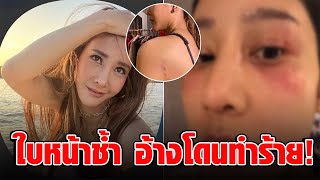 ชาวโซเชียลสงสัย หลังมือปริศนา โพสต์ภาพแตงโม