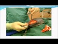 Cruciate repair in a dog