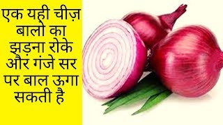 एक यही चीज़ बालो का झड़ना रोके और गंजे सर पर बाल ऊगा सकती है /Magical Benefits of Raw Onion