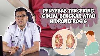 PENYEBAB TERSERING GINJAL BENGKAK ATAU HIDRONEFROSIS - DOKTER SADDAM ISMAIL