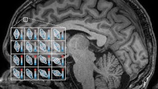 Introduction to Diffusion-Weighted MRI and Microstructure Imaging